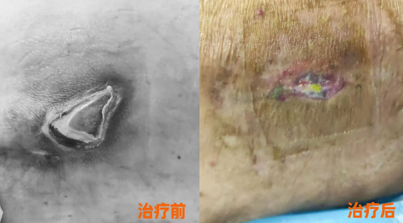 聚焦复杂老年护理：福州国德老年医院个体化应对方案