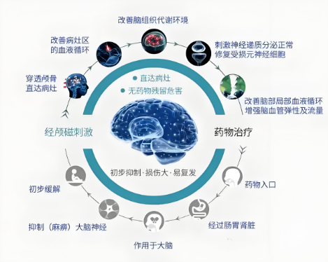 重复经颅磁刺激：无需开刀吃药，用“磁力”唤醒大脑自愈力！